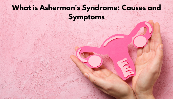What is Asherman's Syndrome: Causes and Symptoms