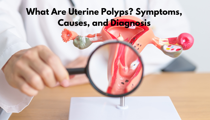 What Are Uterine Polyps? Symptoms, Causes, and Diagnosis