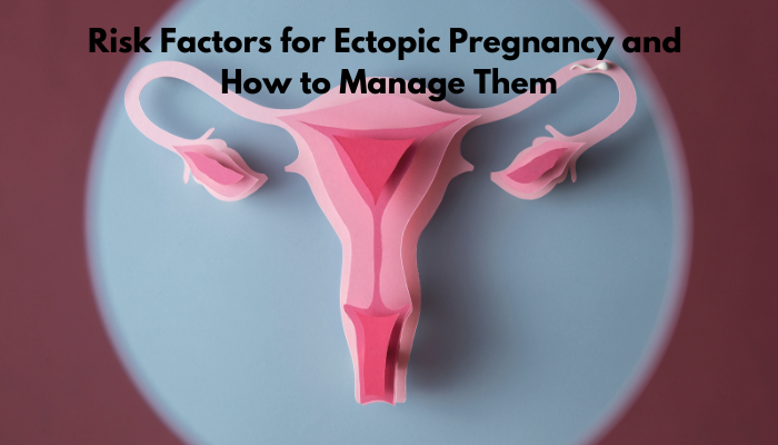Risk Factors for Ectopic Pregnancy and How to Manage Them