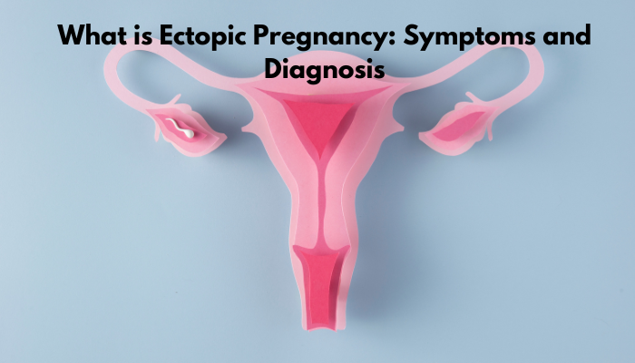 What is Ectopic Pregnancy: Symptoms and Diagnosis