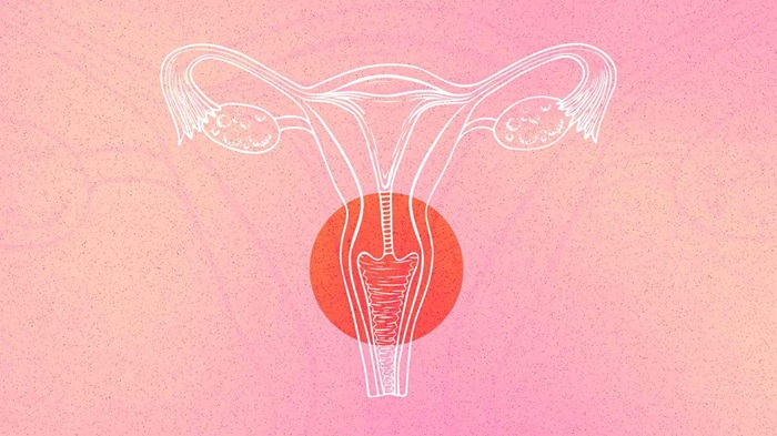 Cervical Cancer: Symptoms, Risk Factors, and Screening